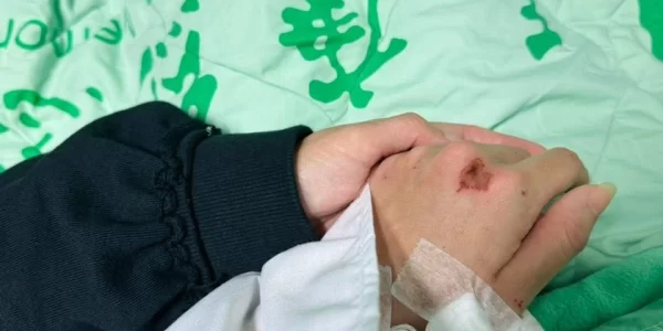 八點檔女星驚傳車禍遭撞飛！緊急開刀治療　劇組證實：角色將換人出演